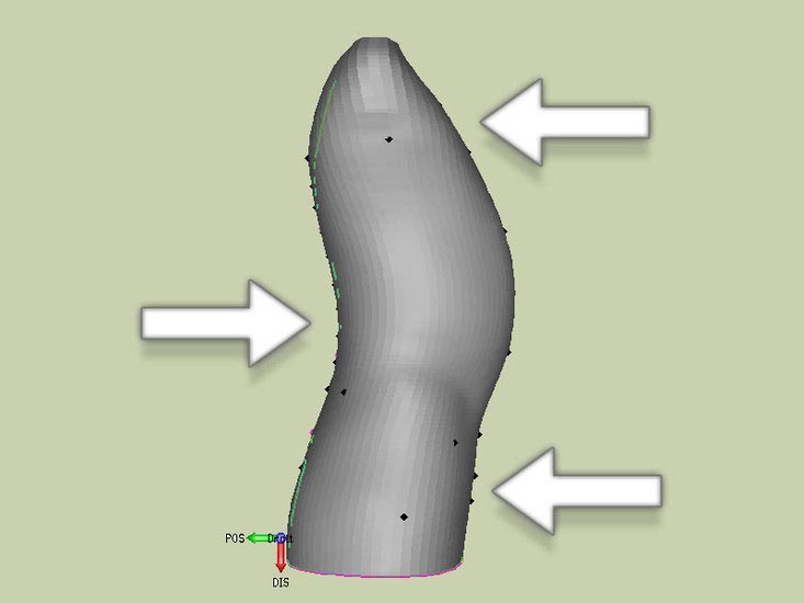 Corset de fracture vertbral - Corset bivalve